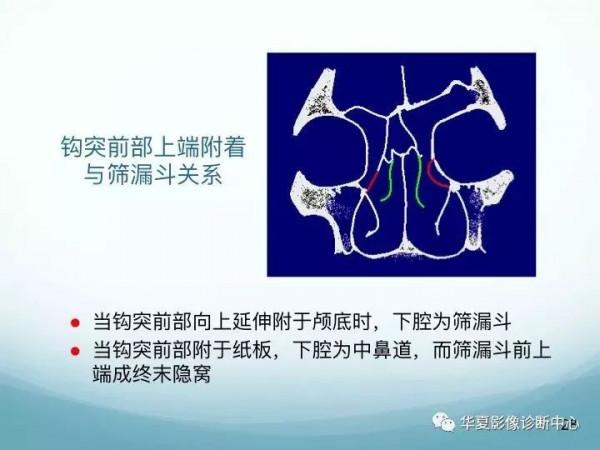 頭頸五官CT斷層解剖圖及常見病影像診斷