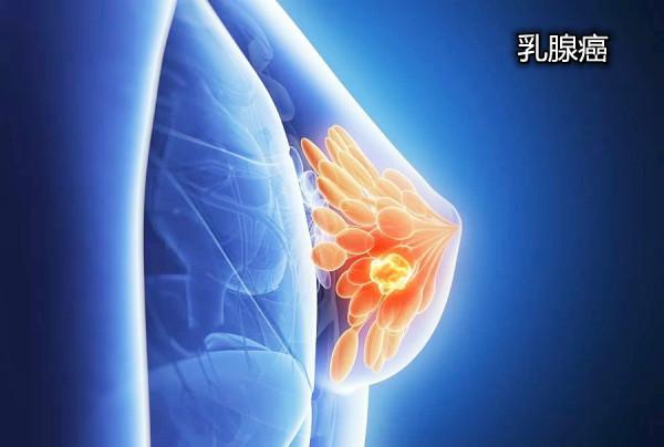 花了幾百萬，人卻沒能保住，癌症晚期究竟要不要花光積蓄去治療？