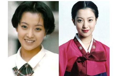 韓流明星過度整容到底有多恐怖？金喜善垮臉，蔡琳險些認不出來