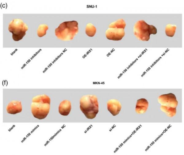 中南大學湘雅第三醫院團隊論文因大量圖片修改問題遭質疑 中南大學湘雅第三醫院團隊論文因大量圖片修改問題遭質疑