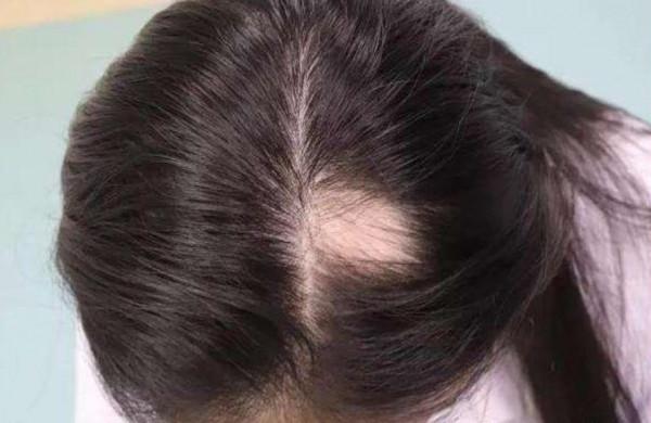 寶寶頭髮是發育的風向標，如何透過頭髮，判斷寶寶的發育情況？