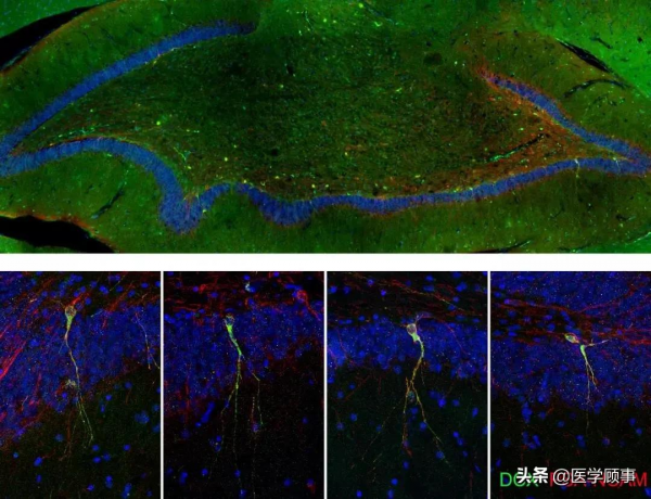 成年人腦內不再有新生神經元 成年人腦內不再有新生神經元