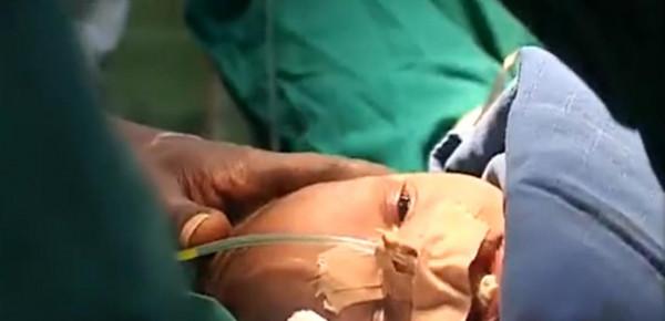 非洲醫院做手術，醫生就到點直接下班了