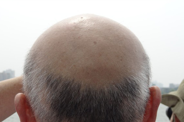 年過五十，想延緩衰老，提升生活質量？做好4件事很重要