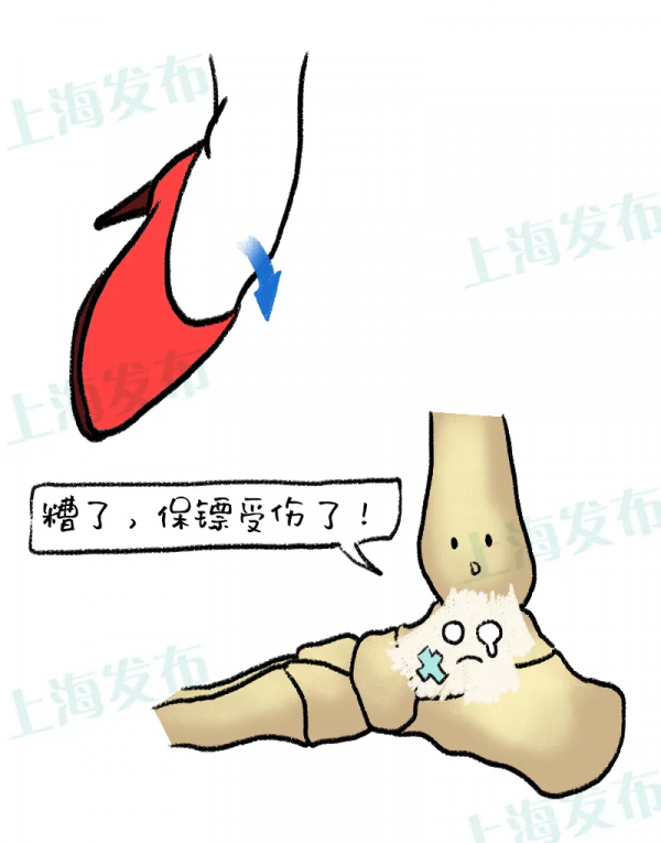 【醫聊】哎呀，又崴腳了！踝關節求關注~