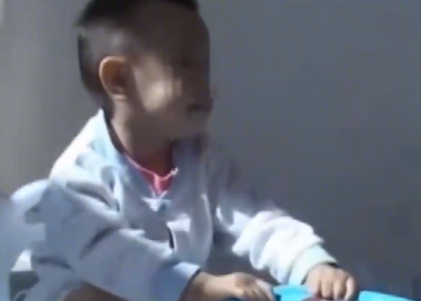 真實故事：陝西1歲幼童患怪病，身體長出鐵釘，醫生查明真相