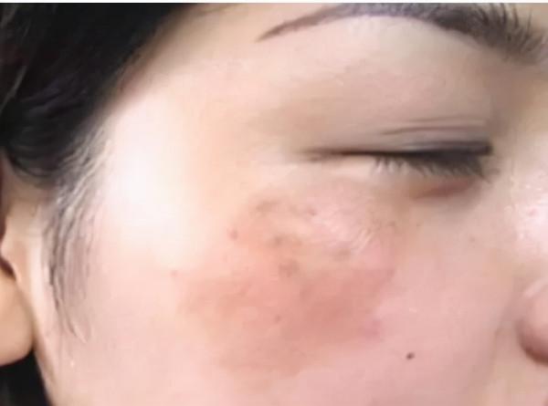 吃鹽多了對身體有害，當身體出現4個跡象時，或在提醒你鹽吃多了