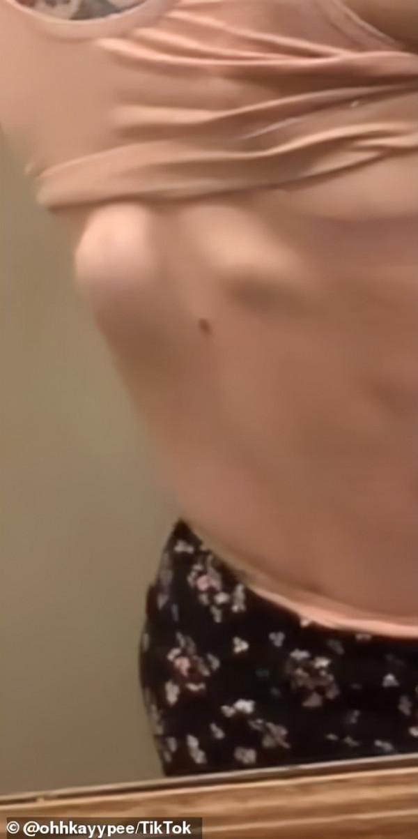 美國27歲網紅去世…18歲出現黑痣沒管,三年後:癌症晚期 美國27歲網紅去世…18歲出現黑痣沒管,三年後:癌症晚期