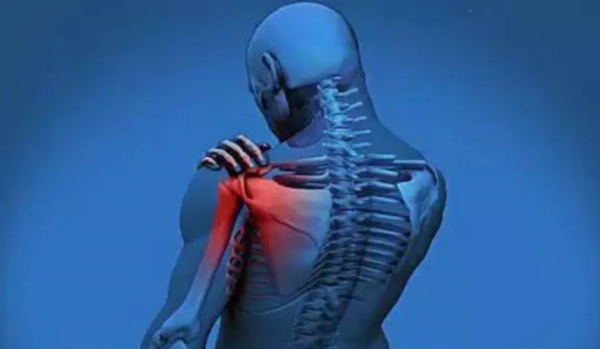 產生痺症的原因，痺症病因病機，中醫對痺症的辯證，痺症的治療