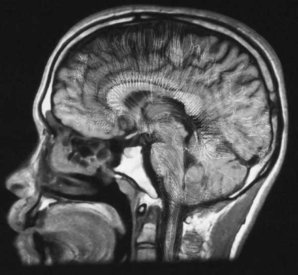 挑戰唯物論?諾獎得主:意識的產生可能是大腦內量子疊加的結果 挑戰唯物論?諾獎得主:意識的產生可能是大腦內量子疊加的結果