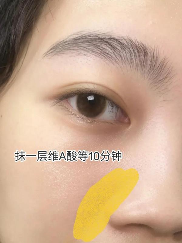 不曉得咋淡法令紋的可以看~看