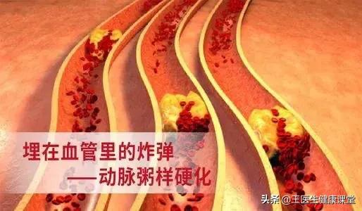 長期高血壓不控制真的會傷你的心，典型病例分享