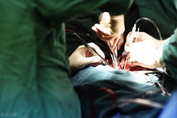 男子春節後腹痛發熱，檢查肝臟&OpenCurlyDoubleQuote;被掏空了&rdquo;，切開後醫生頭皮發麻