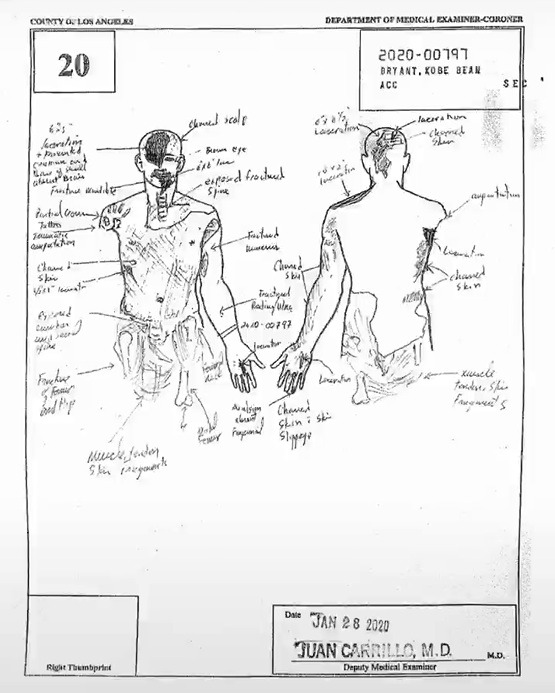 科比失事飛行員首次曝光:飛行途中迷向,手動駕駛導致碰撞山體 科比失事飛行員首次曝光:飛行途中迷向,手動駕駛導致碰撞山體