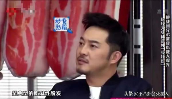 明星&OpenCurlyDoubleQuote;禿頂&rdquo;群像，中年男星頭頂稀疏成重災區，女星靠假髮片社交