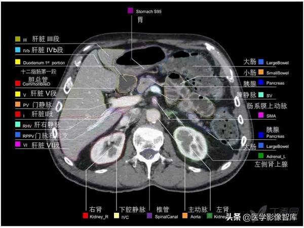 CT斷層解剖圖譜最全總結「推薦收藏」 CT斷層解剖圖譜最全總結「推薦收藏」