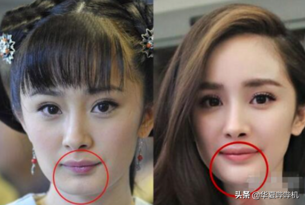 明星大型“翻車”現場，她們是如何整容變毀容的