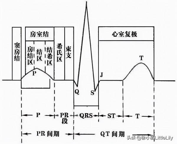 這樣教你看心電圖,沒有理由看不懂 這樣教你看心電圖,沒有理由看不懂