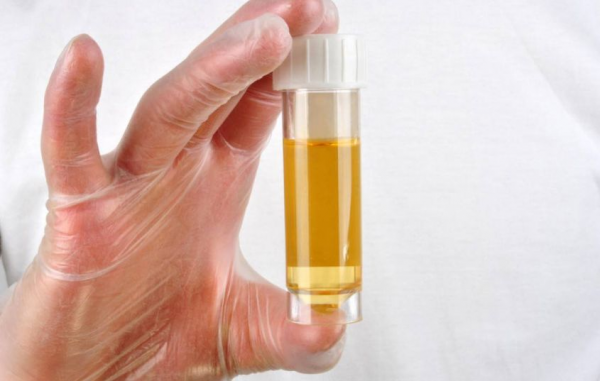 血常規的結果應該怎麼看？主要看3個指標，手把手教你看懂血常規