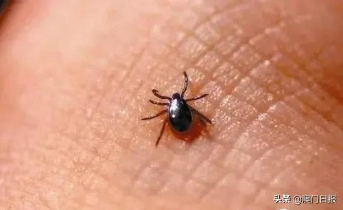 又多一人被恙蟲叮咬 又多一人被恙蟲叮咬