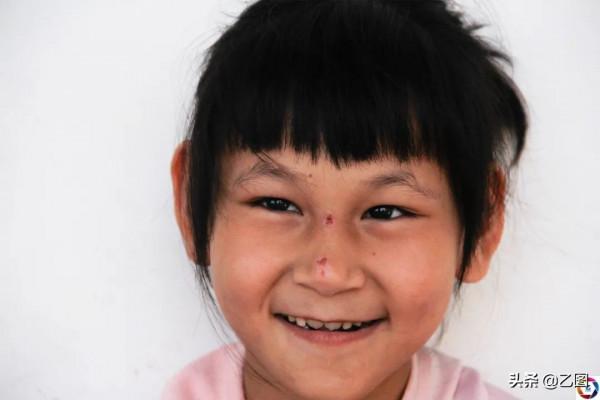 女童患怪病每天對人笑，媽媽以為她是天使，看到診斷書後痛哭不已