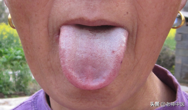 生氣是毒藥,讓人抑鬱,讓人生病;開心是良藥,治癒生活治癒疾病 生氣是毒藥,讓人抑鬱,讓人生病;開心是良藥,治癒生活治癒疾病