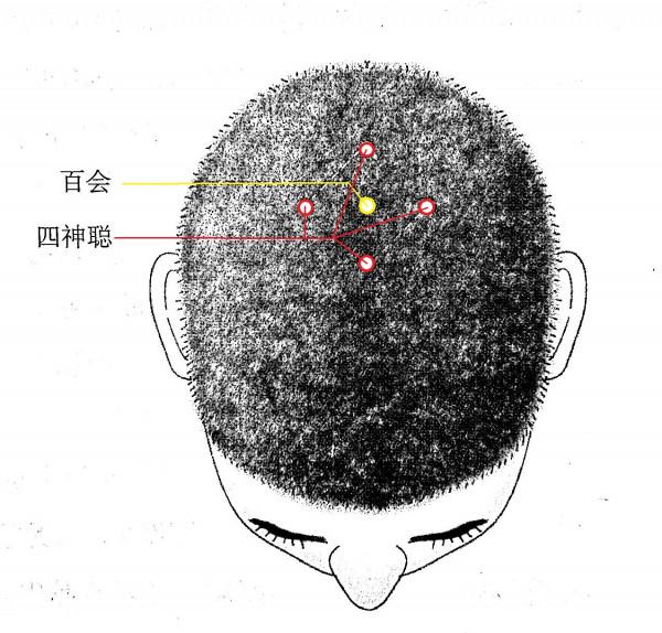 四神聰穴的妙用