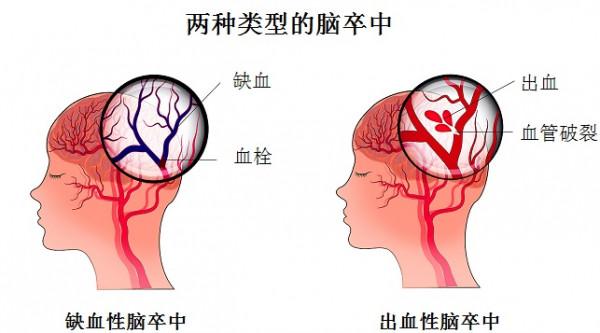 吸菸的人得了大病立馬就能輕鬆戒菸? 吸菸的人得了大病立馬就能輕鬆戒菸?