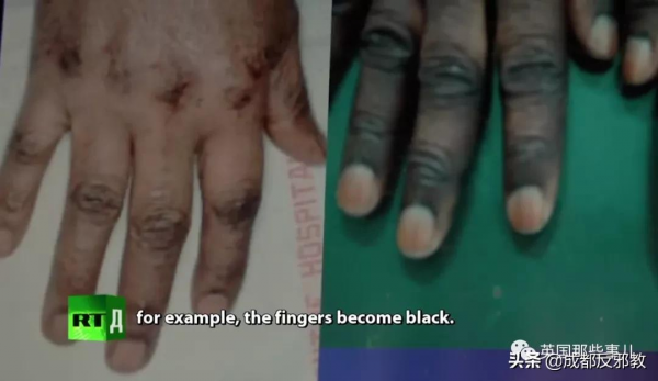 為了變白變美，這個非洲國家的姑娘們用起了漂白劑護膚