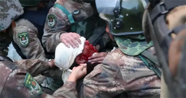 英雄團長祁發寶近況：頭顱模型有明顯缺損，額角傷疤明顯令人痛惜