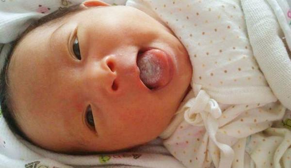 孩子若出現這三種症狀，可能是脾胃虛弱了，父母學會調理很關鍵