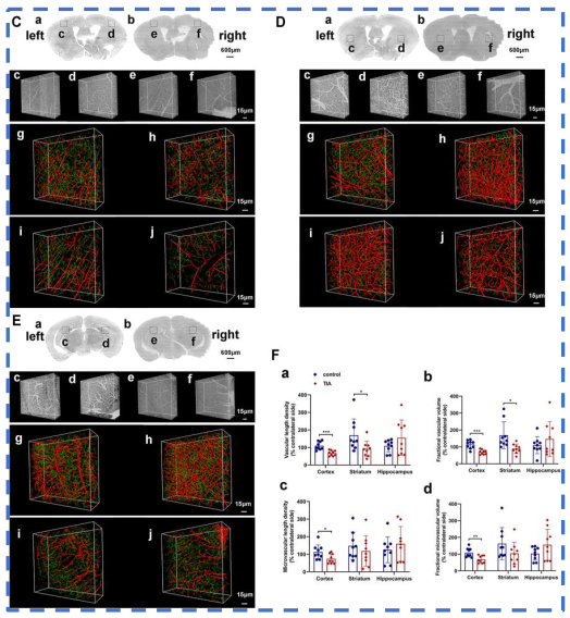 《Frontiers in Pharmacology》:丁苯酞促進TIA模型小鼠血管新生 《Frontiers in Pharmacology》:丁苯酞促進TIA模型小鼠血管新生