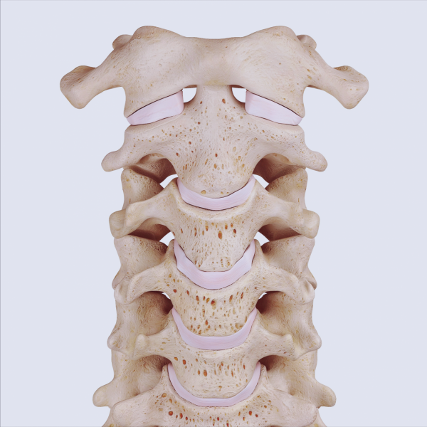 脖子轉動咔咔響嚴重嗎？