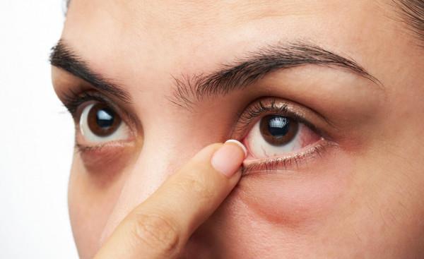 肝癌早期不痛不癢，提醒：一旦出現“2黃1紅”，別拖了，早查肝CT