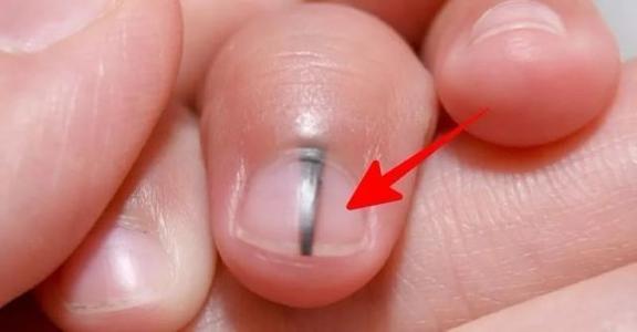 孩子指甲一天一個樣?瞭解這些才能科學成長 孩子指甲一天一個樣?瞭解這些才能科學成長