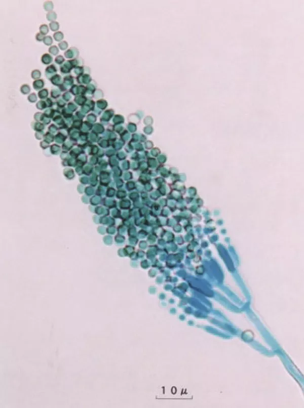 日本科學家遠藤章：發現第一個他汀｜“諾獎值得”系列