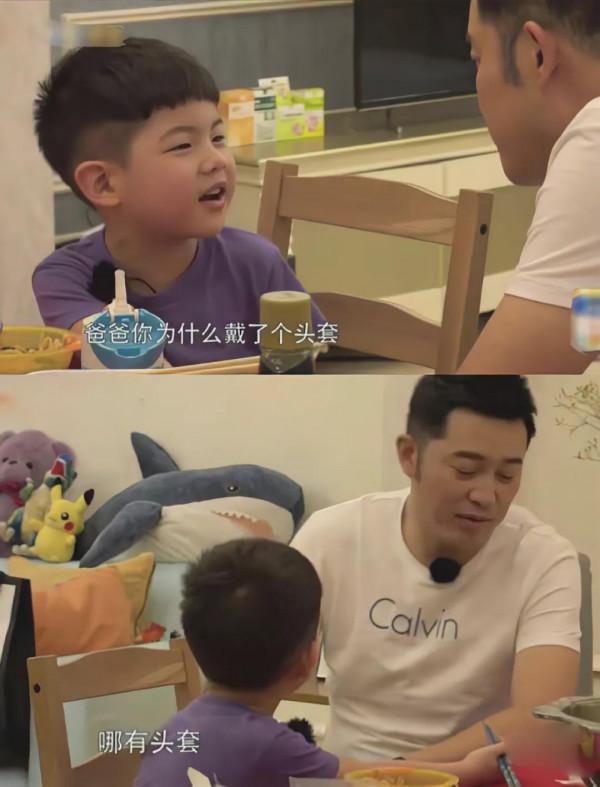 在脫髮面前，明星不比普通人好到哪兒去