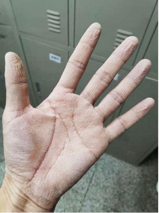 2022年到了，李文亮醫生已經走兩年了；鍾南山：他是一位英雄