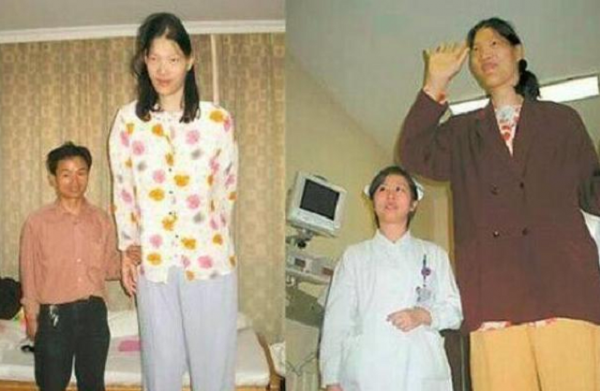 女巨人曾金蓮,14歲比姚明高,一頓吃2斤米,為何遺體至今未火化 女巨人曾金蓮,14歲比姚明高,一頓吃2斤米,為何遺體至今未火化