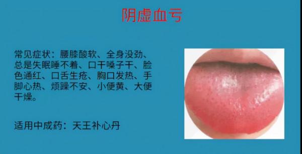 怕冷就補陽？血虛也會！6種血虛情況，實用中成藥大總結