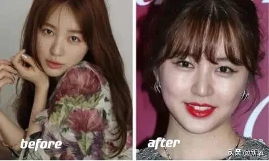 越努力越沒眼看,為什麼南韓女明星個個精緻又腫脹? 越努力越沒眼看,為什麼南韓女明星個個精緻又腫脹?