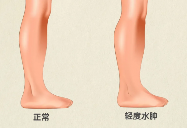 從科學角度解釋：為什麼男生的腿，普遍比女生細？