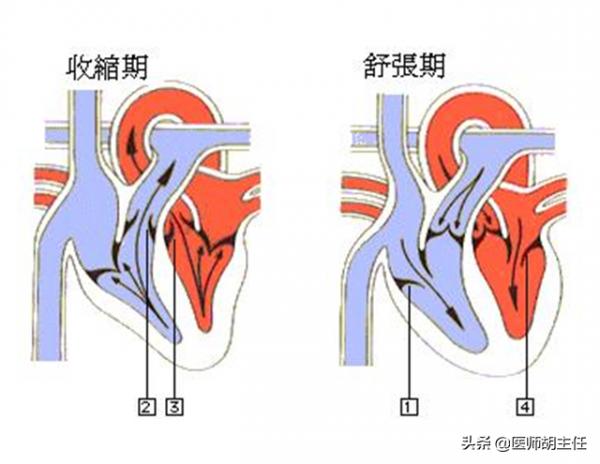 中青年人的高血壓,為何高壓不高,而低壓高?治療上,有何講究? 中青年人的高血壓,為何高壓不高,而低壓高?治療上,有何講究?