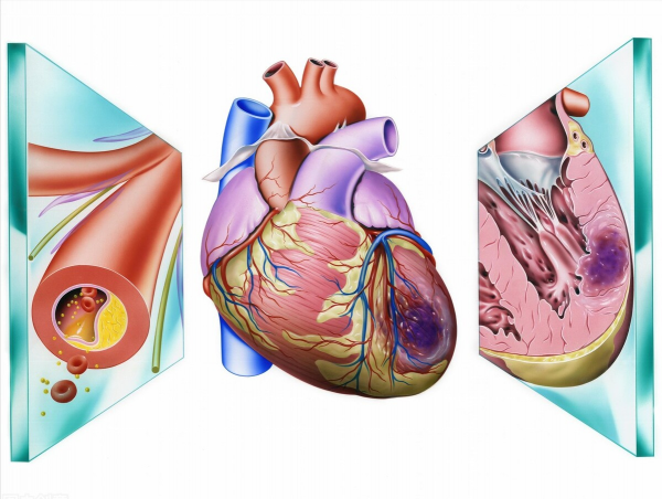 3類降糖藥，兼減重、降壓、調節血脂，改善心肌代謝，保護心血管