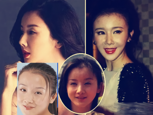 那些“一刀切”削臉的明星還好嗎？有的已垮掉，小方臉成最後贏家