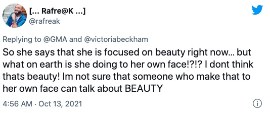 貝嫂也給弄成大厚唇了!外國觀眾看完節目狂呼:別再整了 貝嫂也給弄成大厚唇了!外國觀眾看完節目狂呼:別再整了