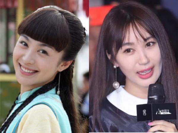 女明星的蘋果肌是“玄學”？王子文奚夢瑤變貴氣，楊紫舒暢太顯老