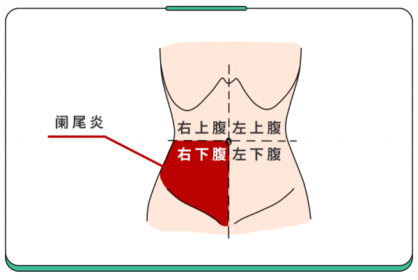 孩子頻繁肚子疼，究竟咋了？1根手指幫你判斷！（大人也適用）