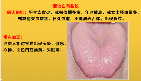 舌頭邊緣有齒痕，舌苔中間有裂紋？3種齒痕5種裂紋，你是哪一種？