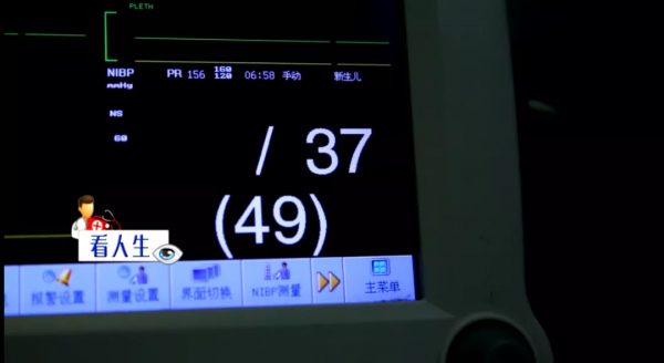 體重僅1.72公斤！呼吸窘迫、急性腎衰、心臟驟停！31周早產兒的“生命闖關”